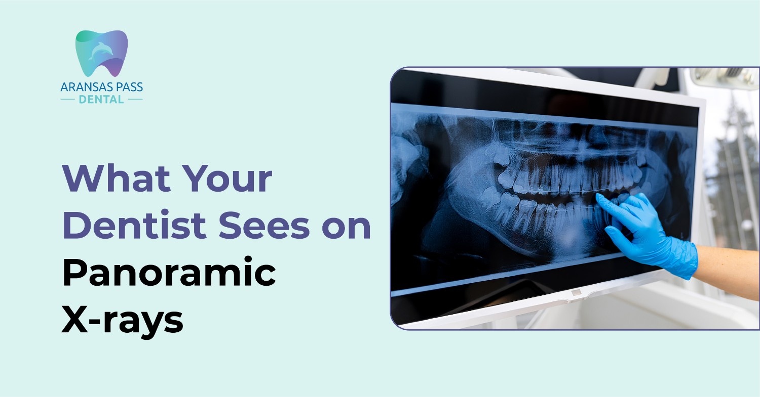 What Your Dentist Sees on Panoramic X-rays
