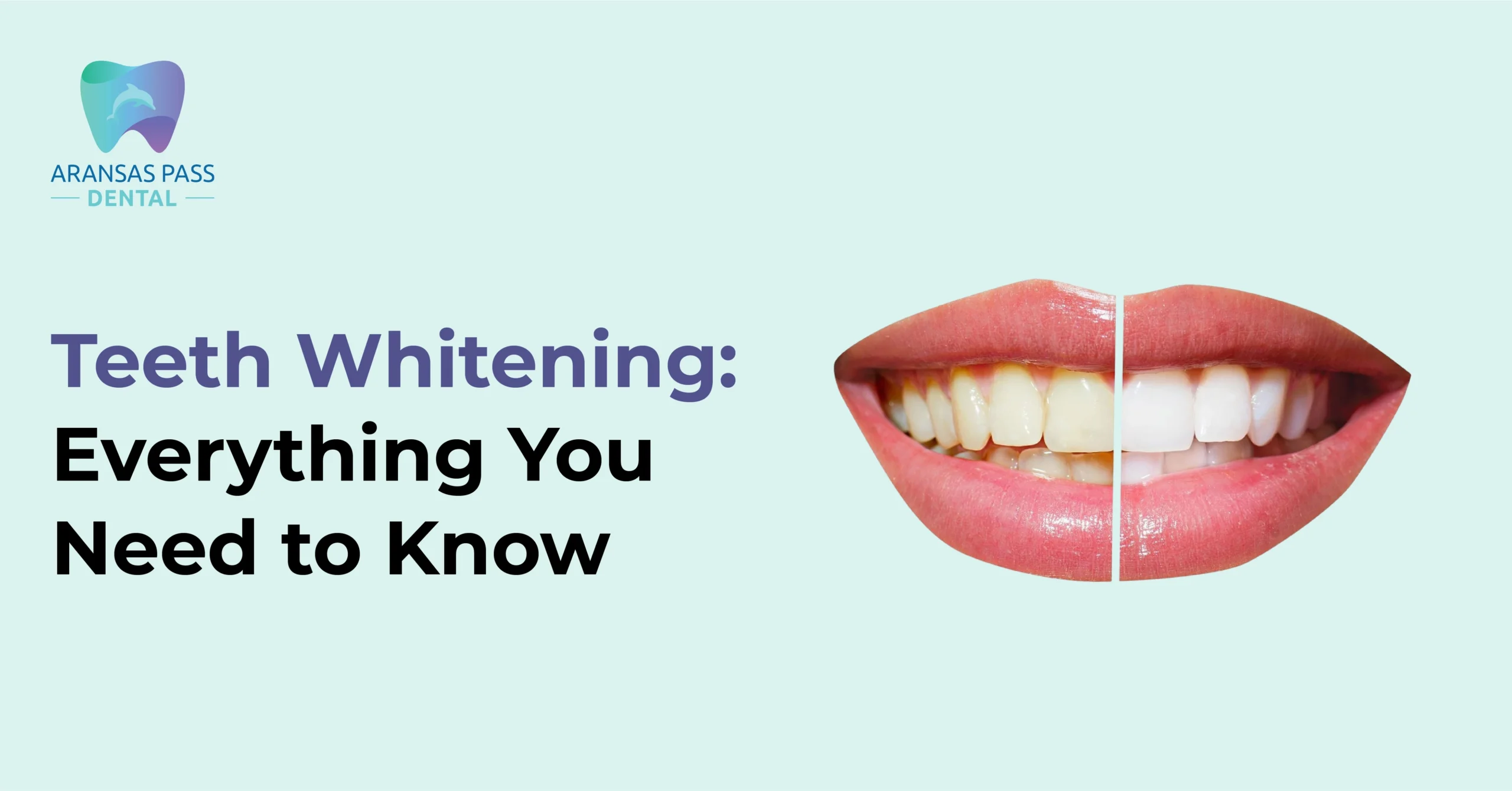 teeth-whitening-guide