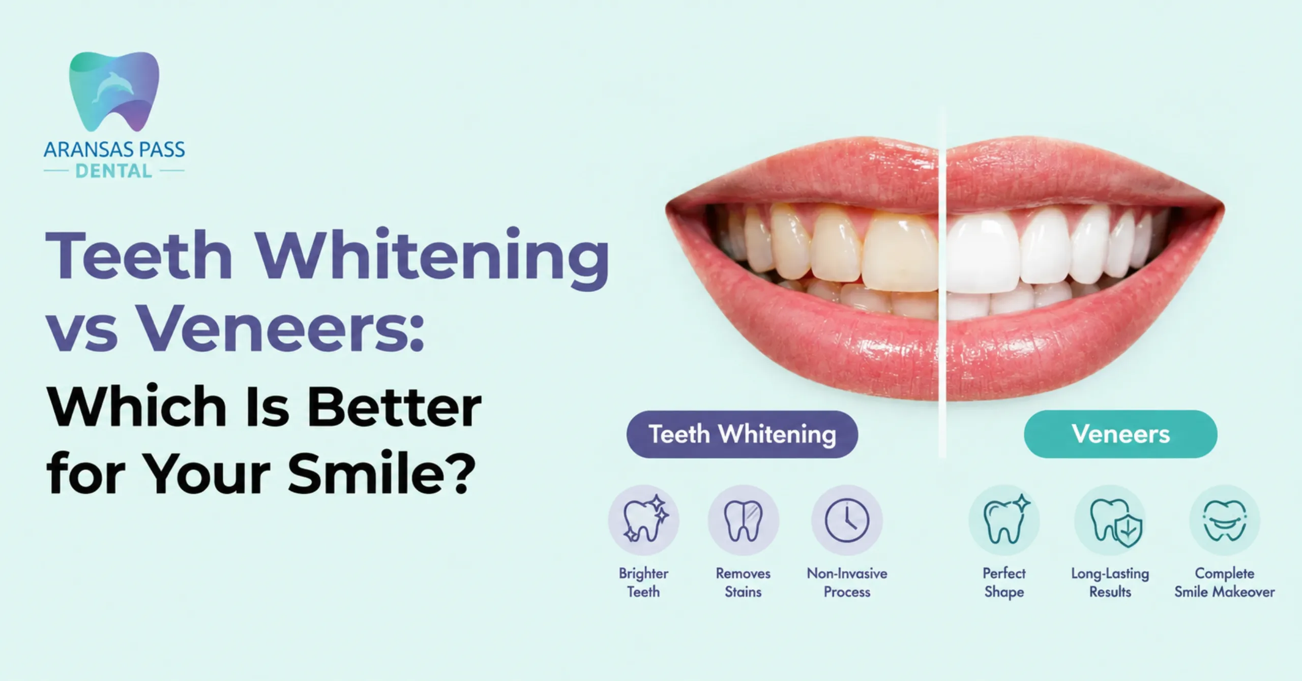 Teeth Whitening vs Veneers: Which Is Better for Your Smile?